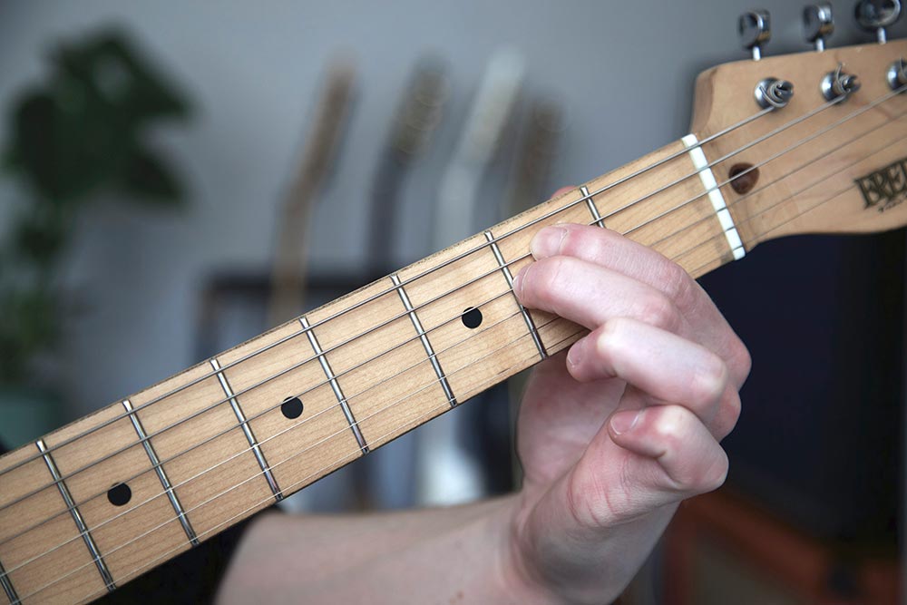 Why Guitar Injuries Are More Common Than Most Players Realise